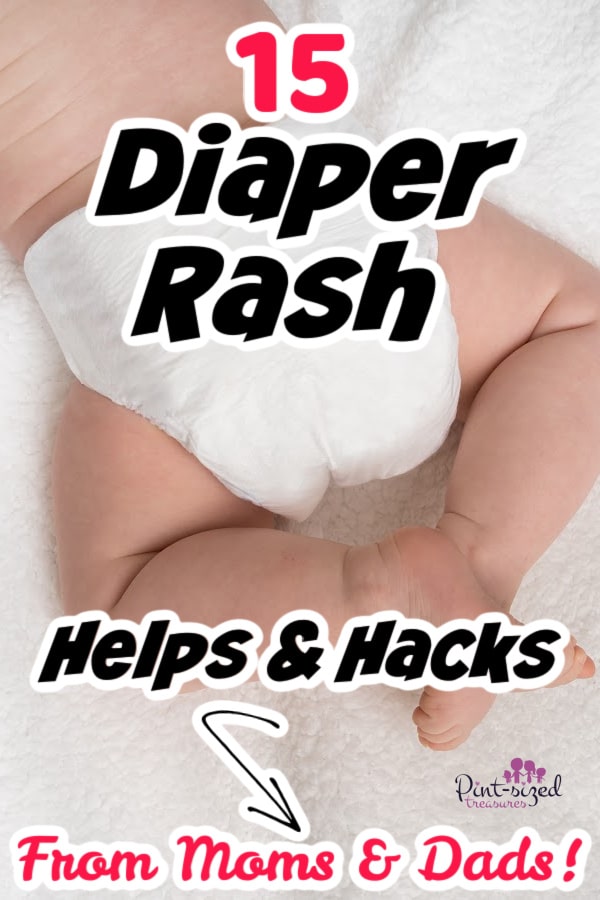 baby in diaper