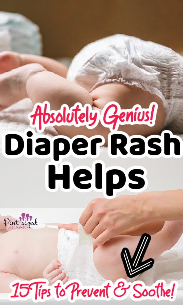baby diaper rash remedies